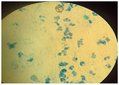 结核菌实用检验—抗酸染色