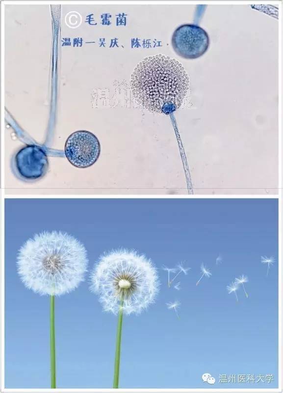 附一院检验科医生所拍的显微镜下真菌美图引起热议