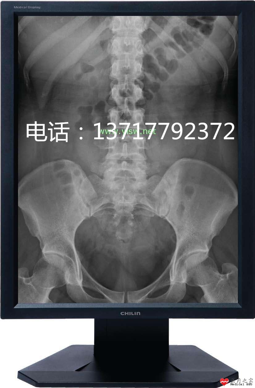2MOZO台湾奇菱医用显示器.jpg