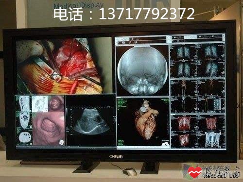 3MOZO台湾奇菱医用显示器.jpg
