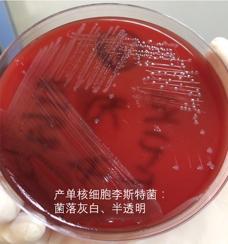 【检验临床面对面】初识产单核细胞李斯特菌
