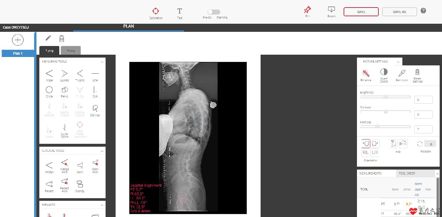 unid-spine-plan-imaging-analysis-screen.jpg