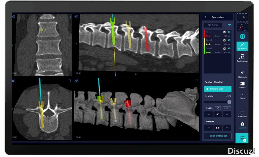 Spine-1024x621.jpg